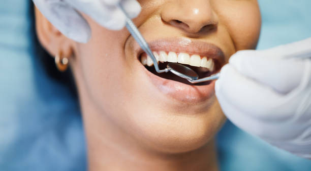 Best Emergency Dental Extractions in West Blocton, AL