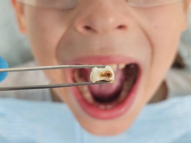 Best Pediatric Emergency Dentist in West Blocton, AL